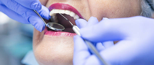 Trusted NC Emergency Dental Service Experts